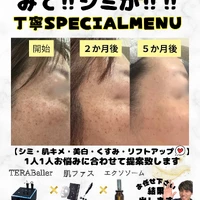 画像374