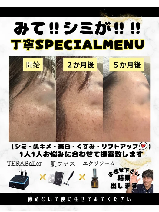 画像374