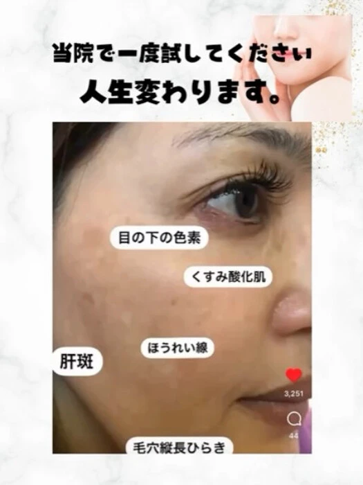 画像387