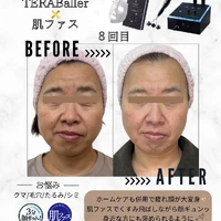 画像421