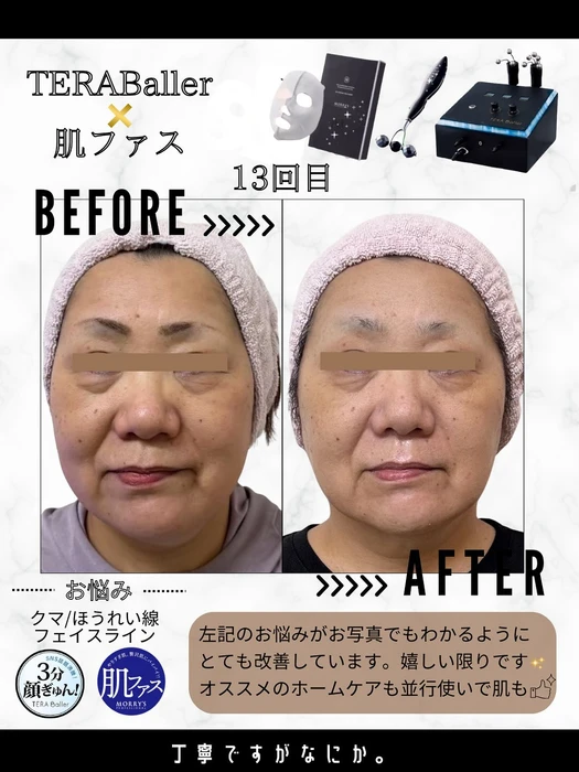 画像482