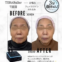 画像496